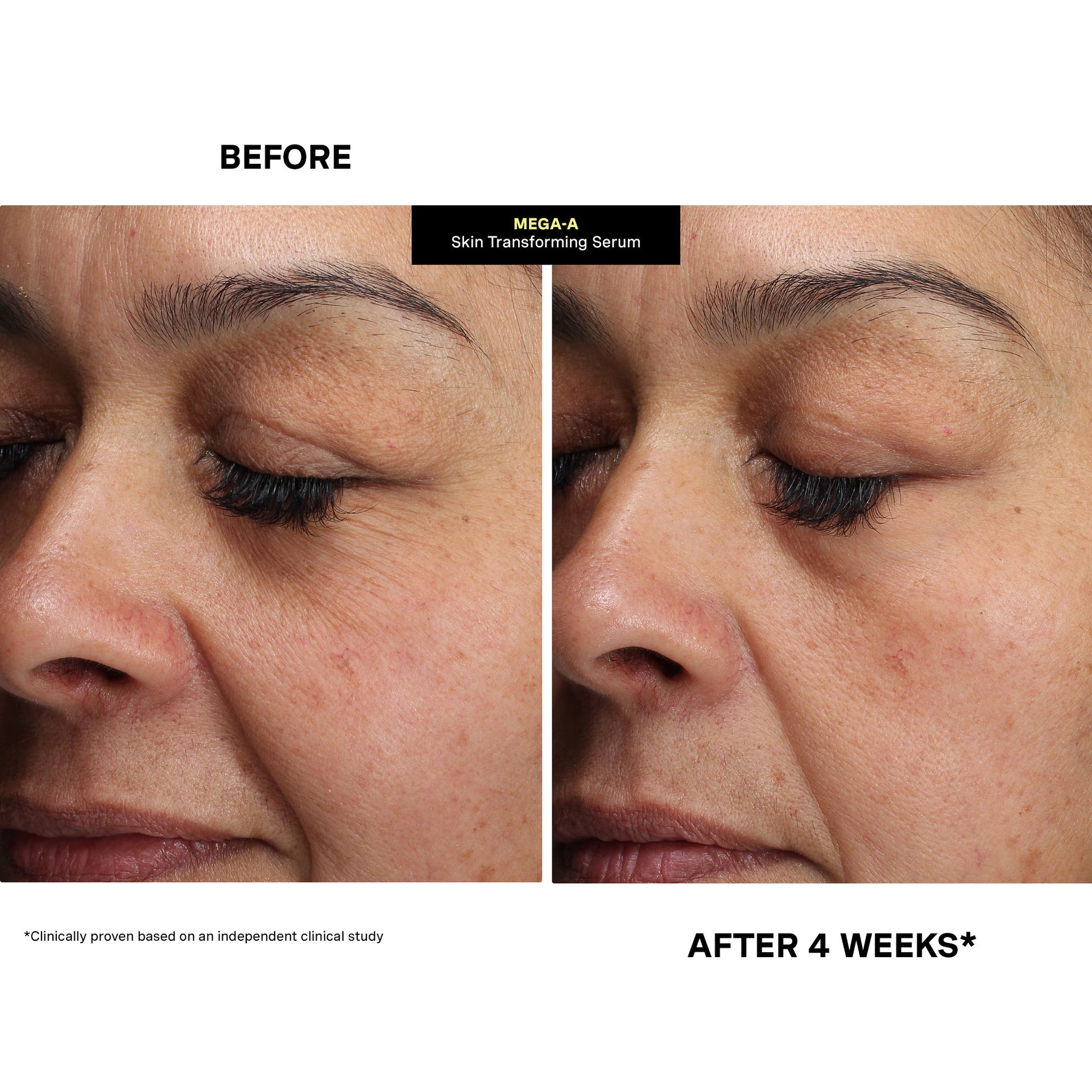 Mega-A™ Skin Transforming Serum